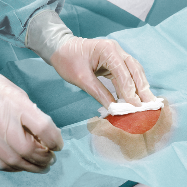 Foliodrape Protect Lochtücher 2-lagig 50 x 60 cm