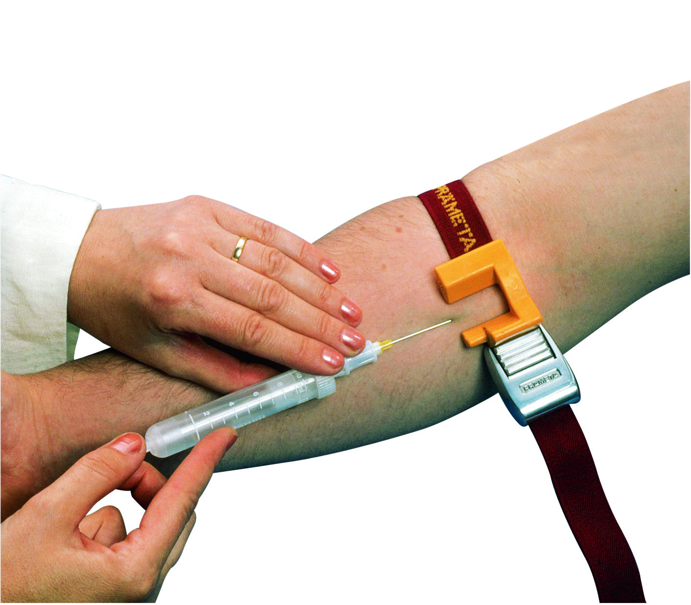 Prämeta Easy Stauer für Problemvenen